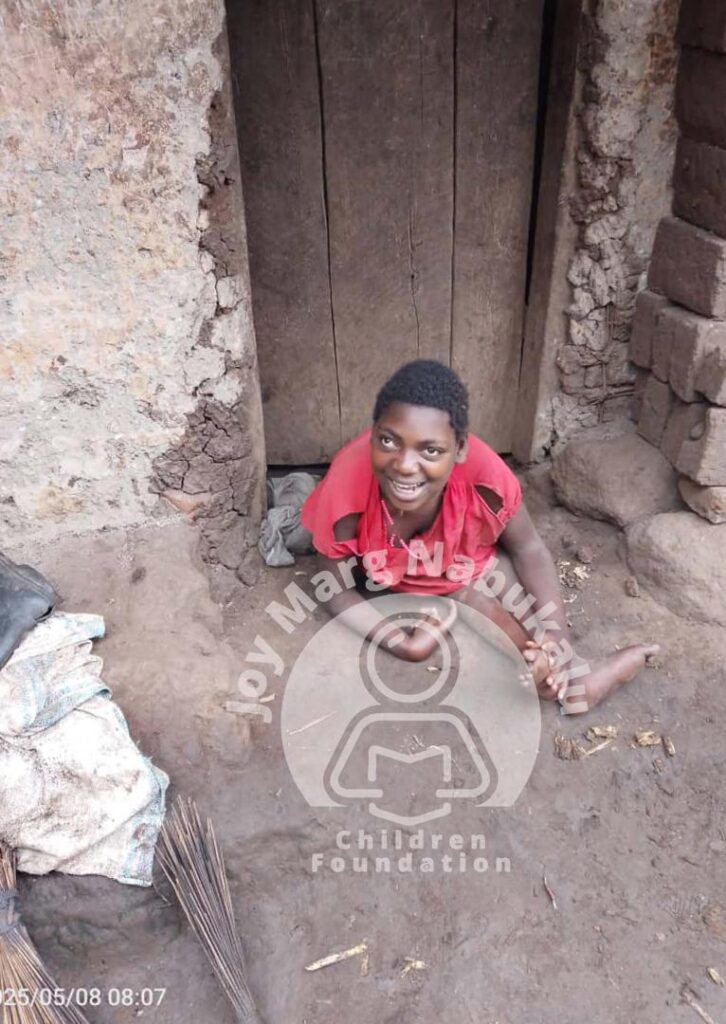 A disabled child posing for a photo.